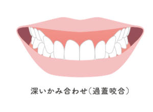 池袋　矯正